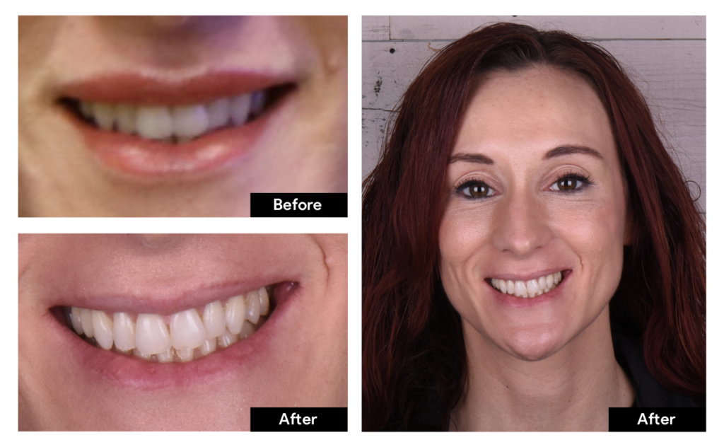 Smile Gallery Cosmetic BMD