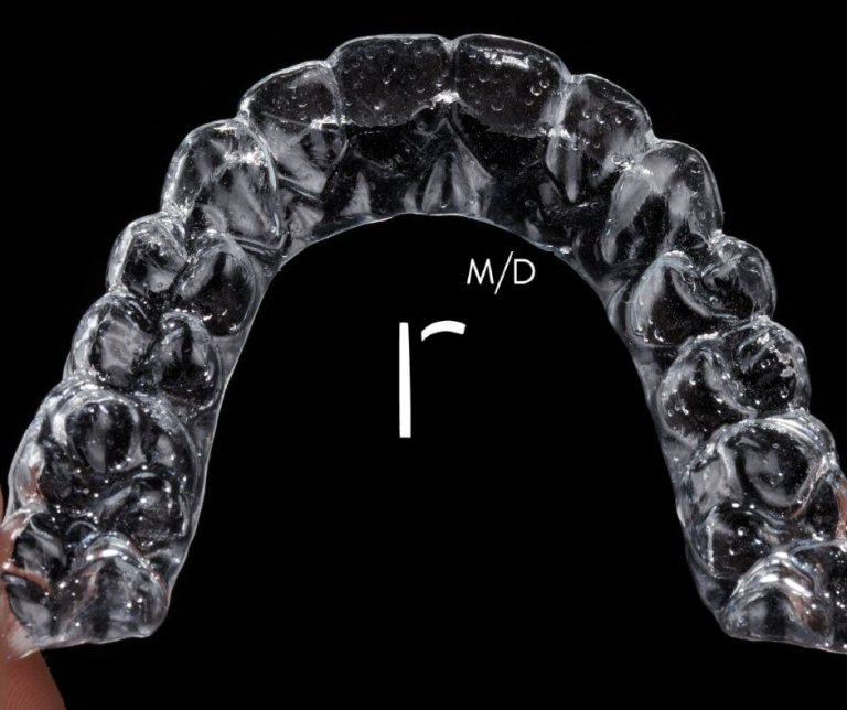 clear aligners