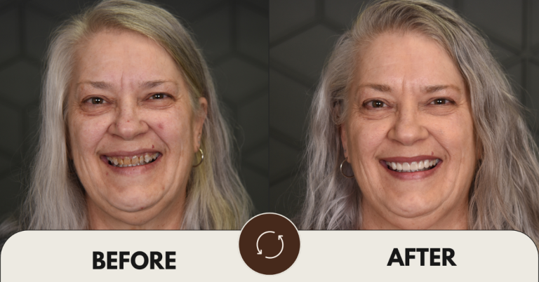 Your Dream Smile Is Within Reach: The Benefits of Cosmetic Dentistry