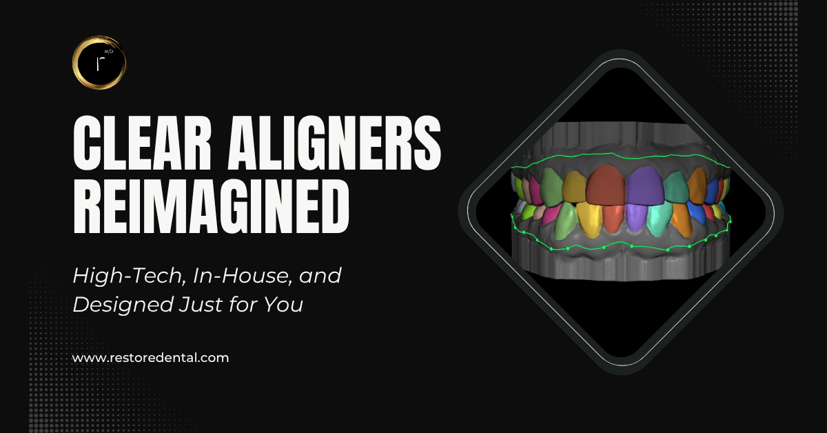 Clear Aligners Reimagined: High-Tech, In-House, and Designed Just for You 1 Close-up of a digital dental impression using the iTero 5D scanner to capture a 3D image of a patient’s teeth at Restore Modern Dentistry in Bentonville.