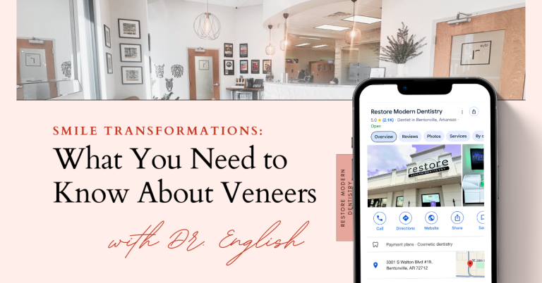 veneers Bentonville AR, porcelain veneers Northwest Arkansas, cosmetic dentistry Bentonville, same day veneers, dental veneers near me, Bentonville smile makeover, natural looking veneers, veneer dentist in Bentonville, CAD/CAM veneers Arkansas, Bentonville cosmetic dentist, smile transformation Bentonville, Restore Modern Dentistry veneers, best veneers Northwest Arkansas, affordable veneers Bentonville, cosmetic smile makeover dentist