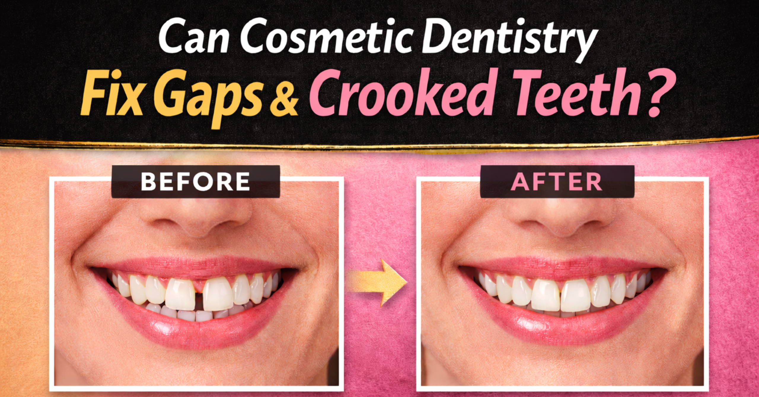 Before and after photos showing how cosmetic dentistry can fix gaps and crooked teeth, featured in a blog post by Restore Modern Dentistry.